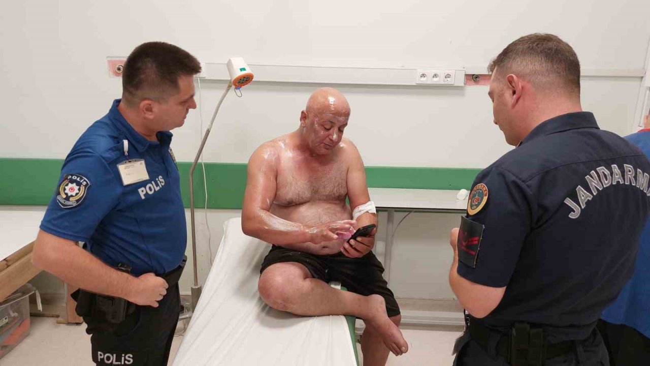 Tır Sürücüsü Tüpgaz Parlaması Sonucu Yanarak Hastanelik Oldu