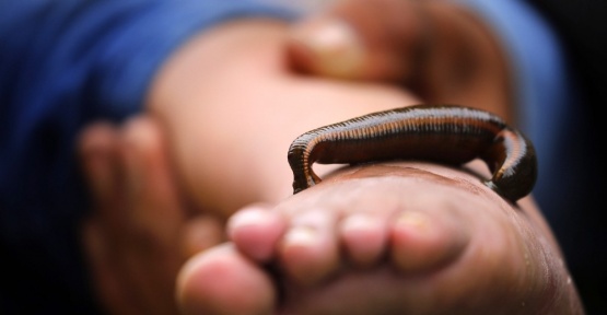 Hindistan’da ilginç sülük tedavisi