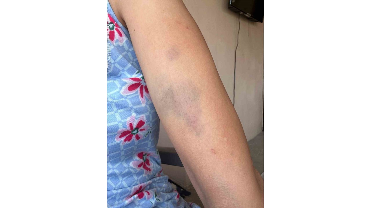 Veteriner Ve Ailesine ‘Sokak Köpeklerini Besledin’ Dayağı İddiası