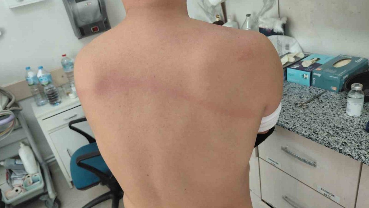 Chp’li Dayakçı Başkan Hakkında ’silahla Kasten Yaralamadan’ İddianame Hazırlandı