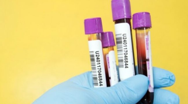 AST nedir? AST neden yükselir ve neden düşer?