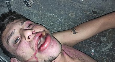 Antalya'da "Böcek yedirip dişlerimi kırdılar" iddiasına 20 yıl hapis talebi