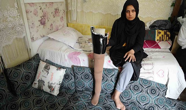 Kahramanmaraş merkezli büyük depremde bacağını kaybetti, eşi terk etti