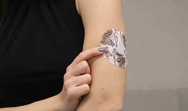 Diyabet tedavisinde yapay zeka destekli teknolojilerle "Yapay Pankreas" dönemi başlıyor