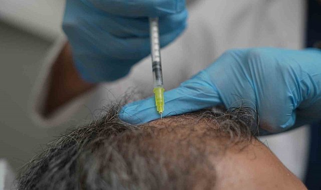 Dökülen saçlar vücudun bir alarmı olabilir