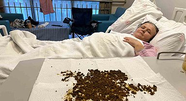 Hastadan çıkan taşları sayamadılar