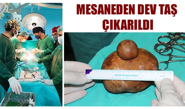 MESANEDEN DEV TAŞ ÇIKARILDI