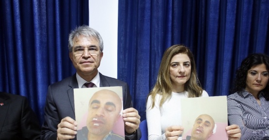 Antalya’da doktora demir çubuklu darp